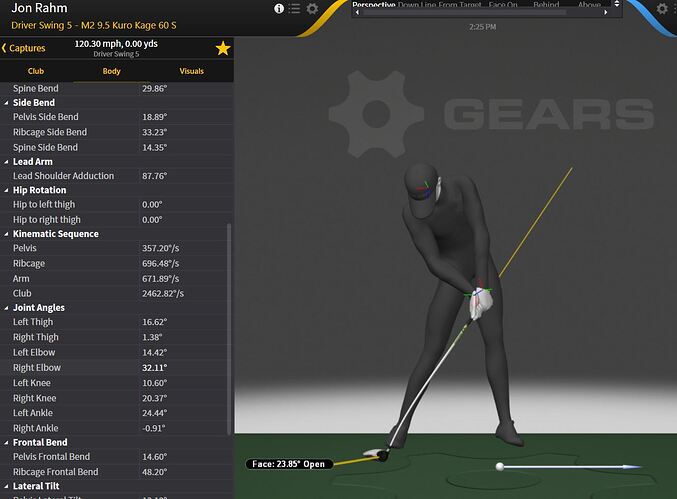 rahm orbit pull later arm straightening Capture